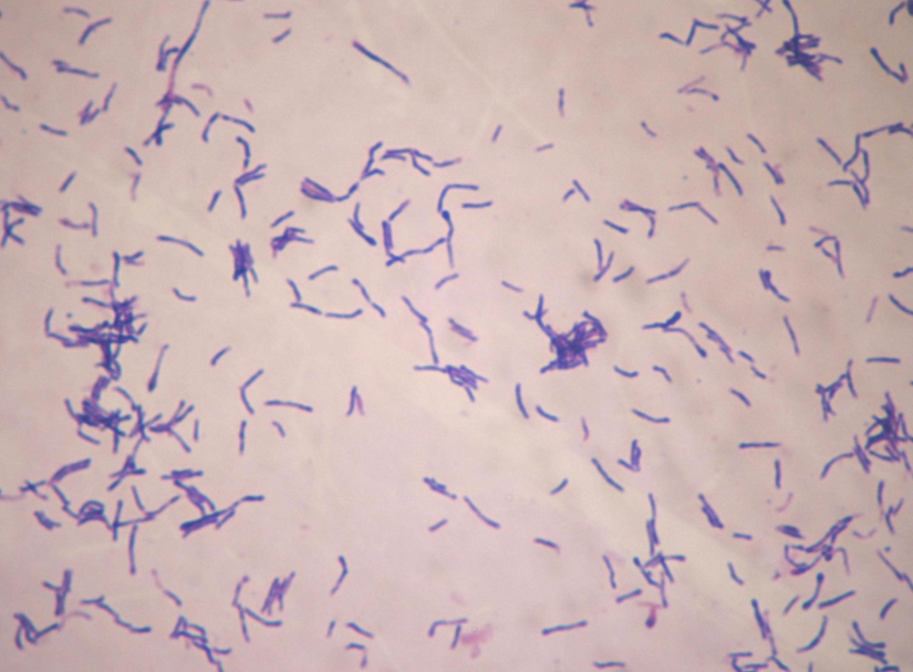 Actinomycosis - Pictures