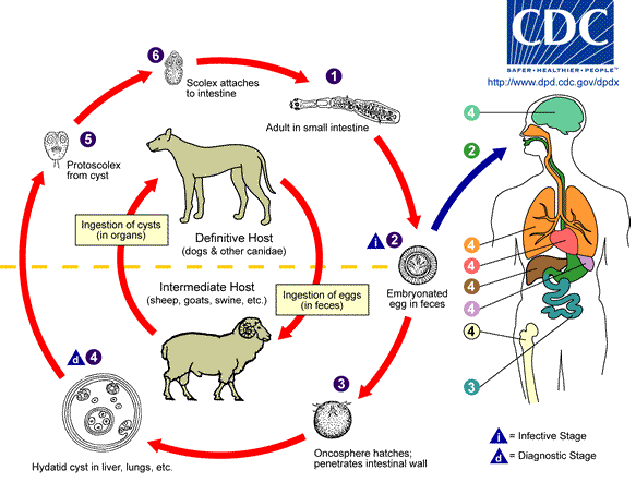 Hydatid disease — Medlibes: Online Medical Library